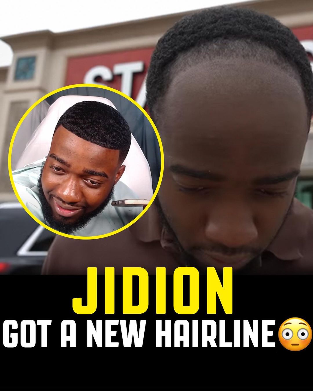 houseofhighlights@instagram on Pinno: JiDion really got a hair transplant  LIVE...